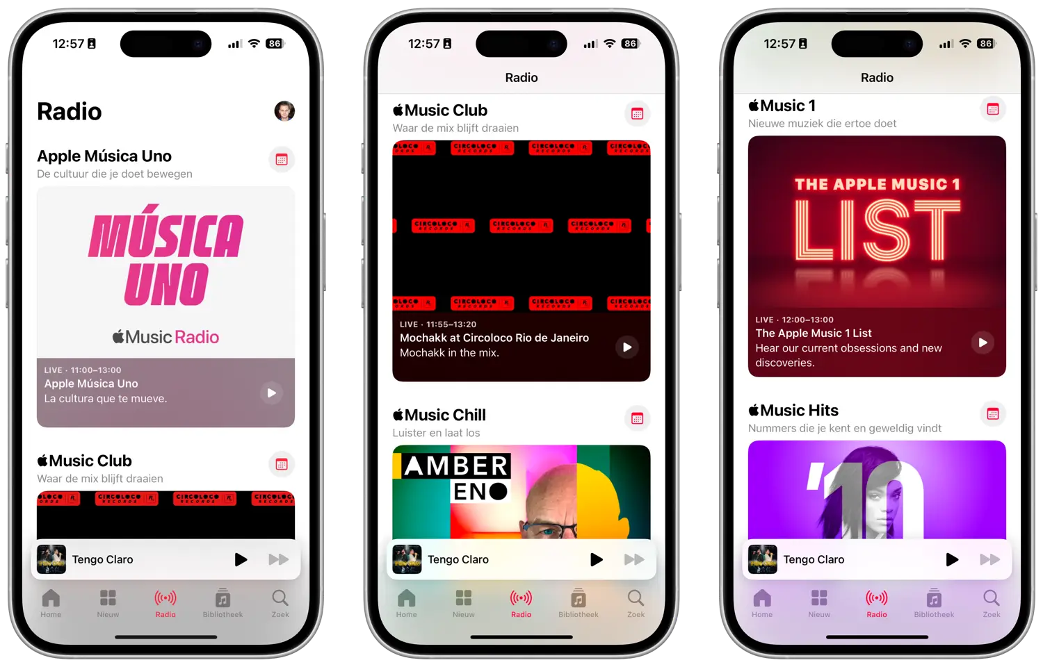 Apple Music 1 live radiostations