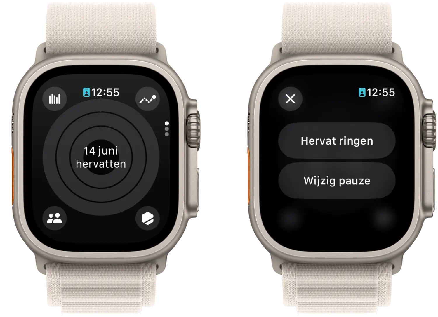 Apple Watch Activity app paused in watchOS 11: Resume or change