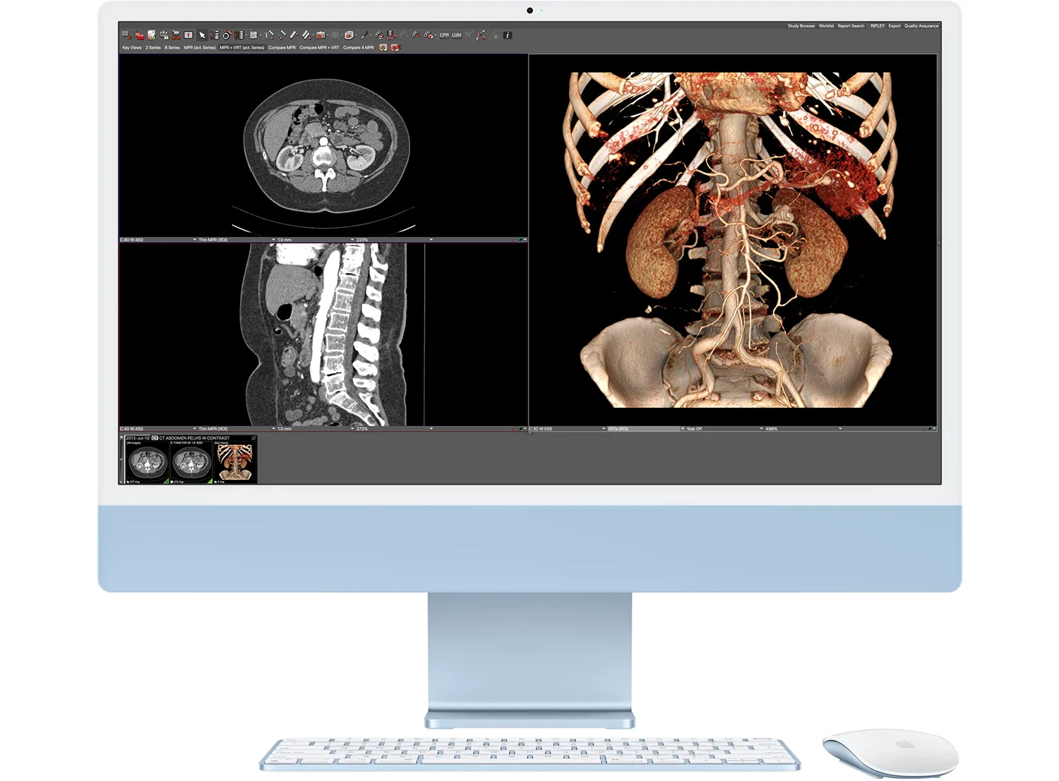 Medische toepassingen op een iMac in de zorgsector